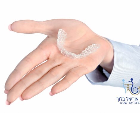 מומחה ליישור שיניים שקוף - ללא גשר